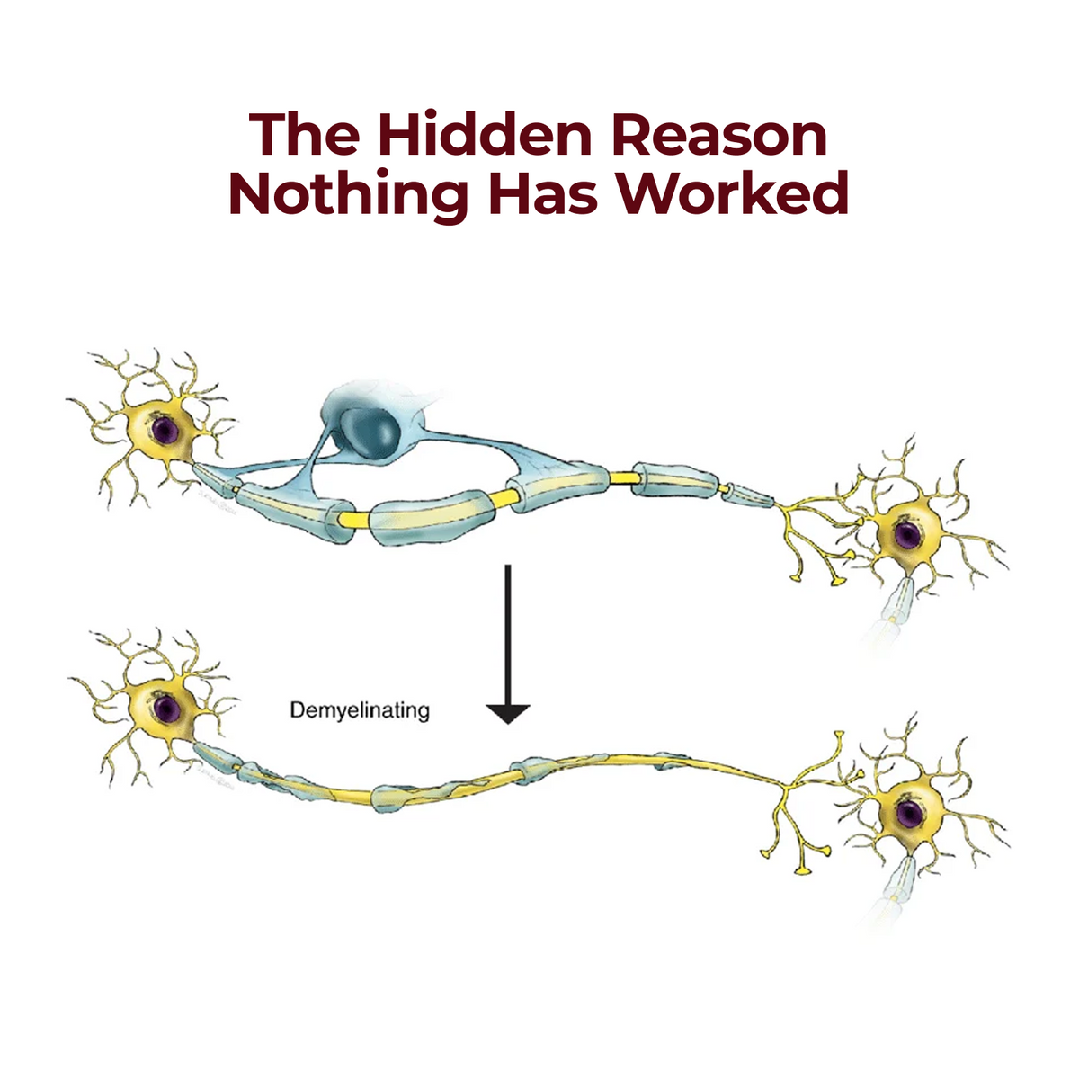 5 in 1 Nerve Protection Complex